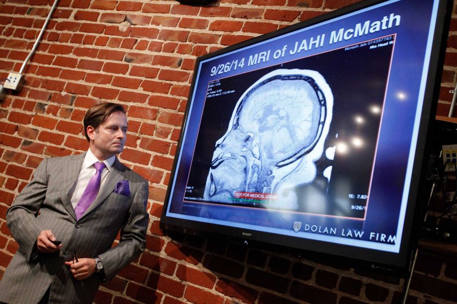 Attorney Chris Dolan looks at an MRI of Jahi McMath at a news conference where he showed video that he says demonstrates that McMath is not brain dead in San Franicisco on Thursday, Oct. 3, 2014. Photo: Mathew Sumner / Special To The Chronicle / ONLINE_YES