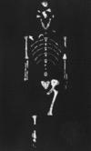 Australopithecus afarensis [Cleveland Museum of Natural History] 