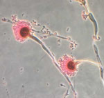 Microscopy of Aspergillus Fumigatus