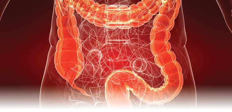bright orange colon and intestines