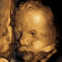 '4D' ultrasound studies effects of smoking on unborn babies
