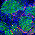Human stem cell-derived beta cells.