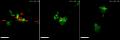 File:Live-Imaging-of-Innate-Immune-Cell-Sensing-of-Transformed-Cells-in-Zebrafish-Larvae-Parallels-pbio.1000562.s015.ogv