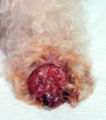Canine malignant melanoma.JPG