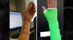 Dodgers' Josh Ravin -- Check Out My Franken-Arm…