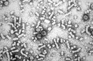 Hepatitis B particles are made of a protein shell with viral DNA inside. Image: CDC