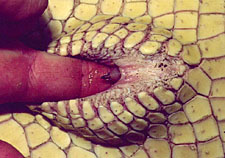 clitoris of adult female