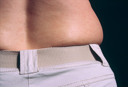 Close-up of woman's fat mid-section and trousers