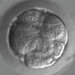 Newly fertilized eggs before gene editing, left, and embryos after gene editing and a few rounds of cell division. A study published on Wednesday announced that edited human embryos can repair common and serious disease-causing gene mutations.