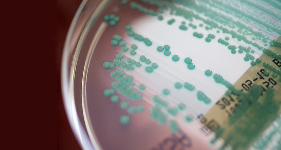Robert-Koch-Institut aktualisiert Datenbank zu Antibiotikaresistenzen