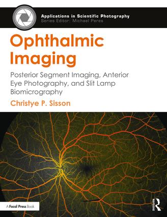 Ophthalmic Imaging: Posterior Segment Imaging, Anterior Eye Photography, and Slit Lamp Biomicrography book cover
