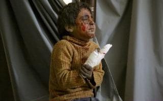 A wounded Syrian child waits to receive medical treatment at a hospital after Assad Regime's attacks over a market place in Eastern Ghouta's Kafr Batna