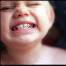 Nearly half of Australian children have at least a moderate amount of plaque on their teeth.