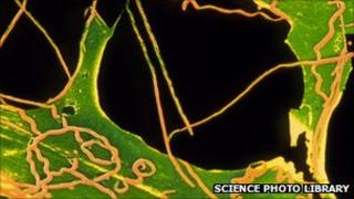 Treponema pallidum, the bacteria that causes syphilis in man