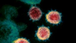 Das Coronavirus unterm Mikroskop | Bildquelle: dpa