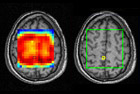 fMRI images of brain