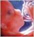 slideshow fetal development