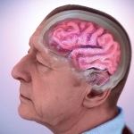 Animation showing an older man's brain