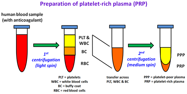 Preparation of platelet-rich plasma (PRP)