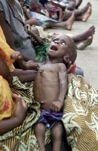 A starving child is held by its mother at the pediatric malnutrition ward at Central Hospital in Lilongwe, Malawi, April 24, 2002. More than 14 million people face hunger and starvation in Malawi and other southern African nations.  (AP Photo/Obed Zilwa)