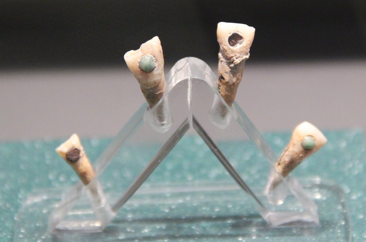 Four human teeth with inlaid stones are on display