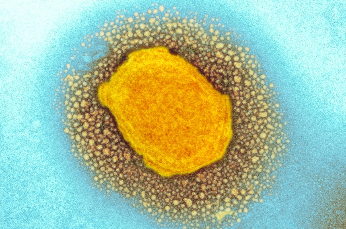 Monkeypox virus particle, colored transmission electron micrograph