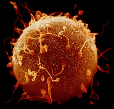 Coloured scanning electron micrograph of sperm on the surface of a human egg during fertilization