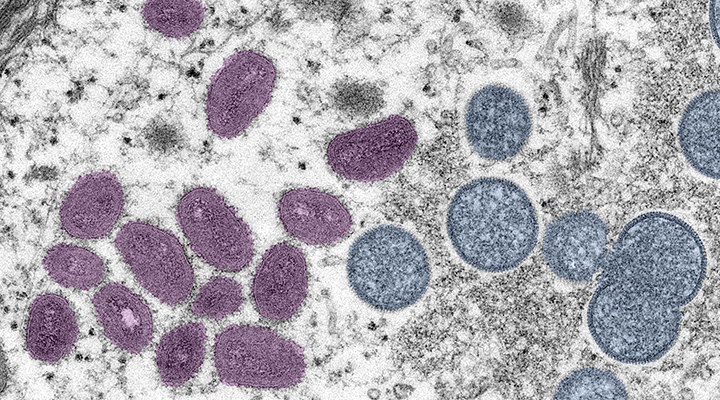 A microscopic image of the mpox virus