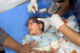 A toddler&#039;s head is stitched up at Kuwaiti Hospital following an Israeli attack on Rafah [Screengrab/Sanad/Al Jazeera]