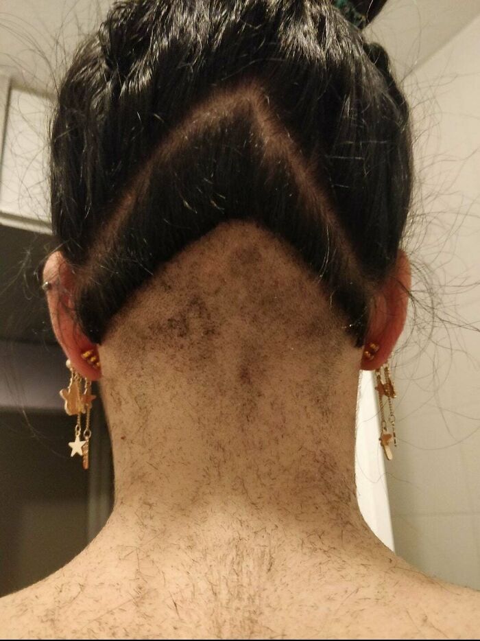 The Result Of Asking My Dad To Go Over My Outgrown Undercut Again. Said He Didn't Want To "Accidentally Shave Too Far"