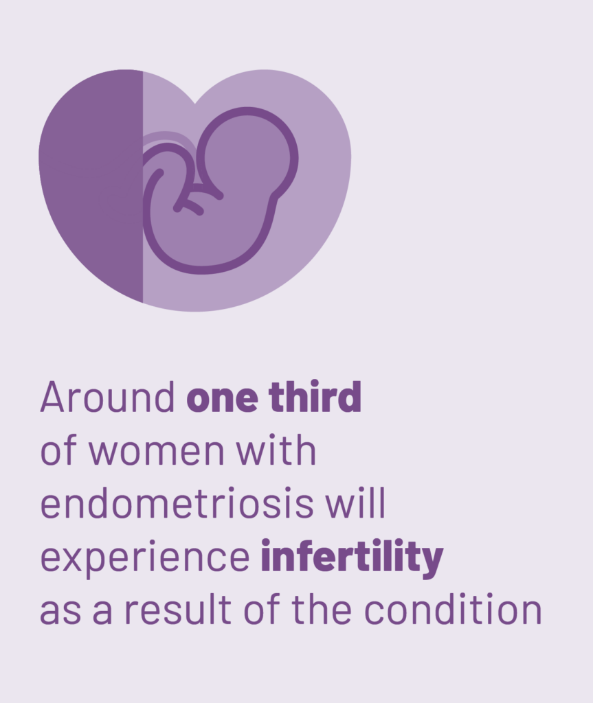 Around one third of women with endometriosis will experience infertility as a result of the condition