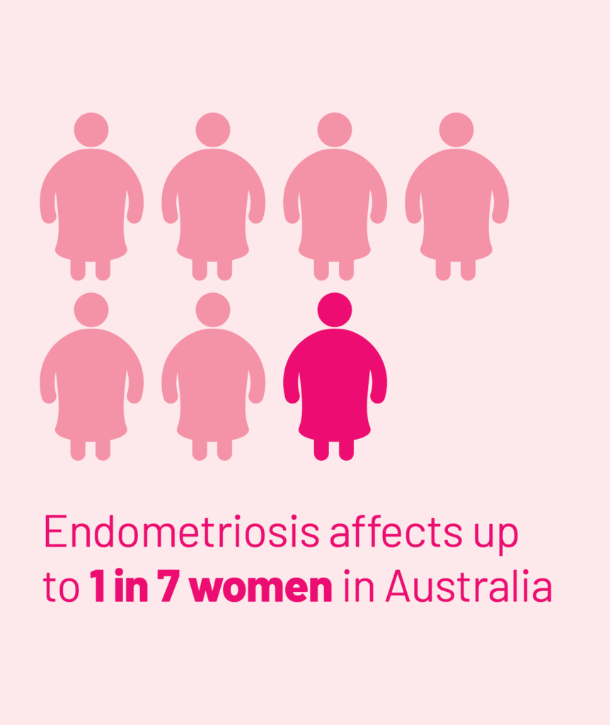Endometriosis affects up to 1 in 7 women in Australia