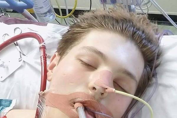 British teenager almost died from lung failure after vaping