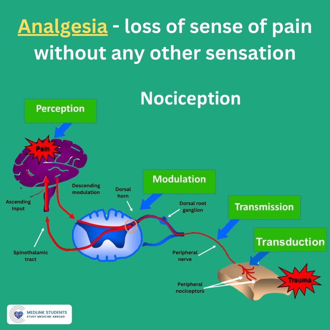 Analgesia - Loss of Sense of Pain Without Any Other Sensation