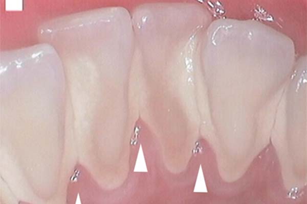 periodontal gum care hawthorn