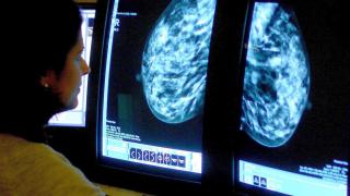 Proposed spending cuts by NHS Tayside would include locum breast cancer cover