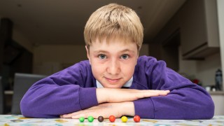 Alex Dixon, 12, has gradually weakened his peanut allergy by building up his intake of M&Ms