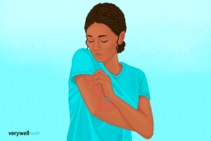 An illustration of a person examining a rash on their arm.