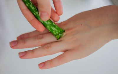 Close up of a white person's hand, they are applying raw aloe to the top of their knuckle.