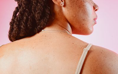 Portrait of a Young Womans Back with Freckles