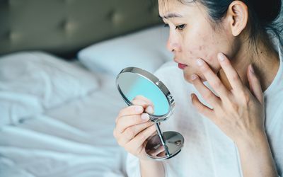 Close up of Asian woman worry about her face when she saw the problem of acne and scar by the mini mirror.