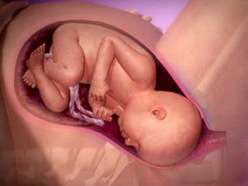 illustraltion of a baby in the uterus engaging the head during labour