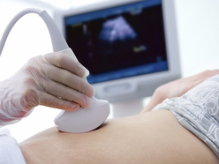 ultrasound wand on pregnant woman's abdomen during her nuchal translucency scan at 12 weeks
