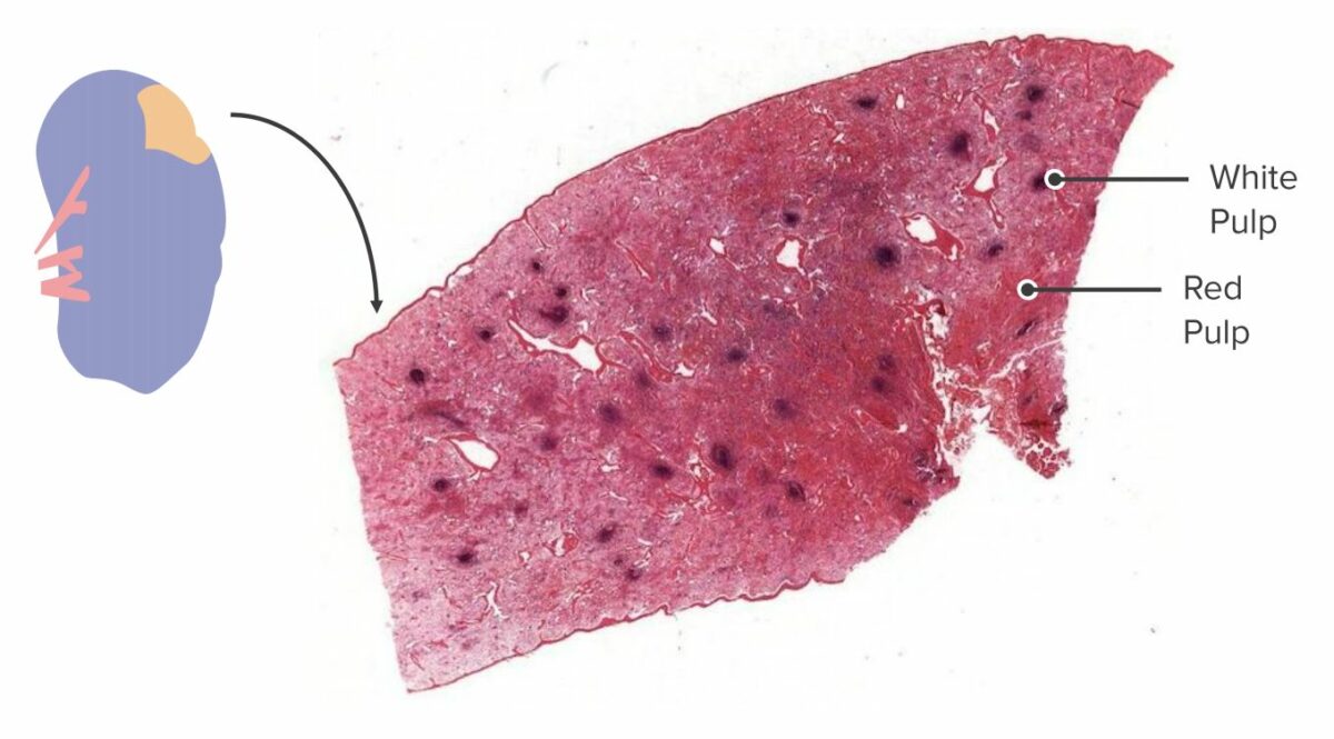 Cross-section of a spleen showing white pulp and red pulp