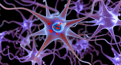 New Parkinson’s disease test can help refine treatments and support more efficient research