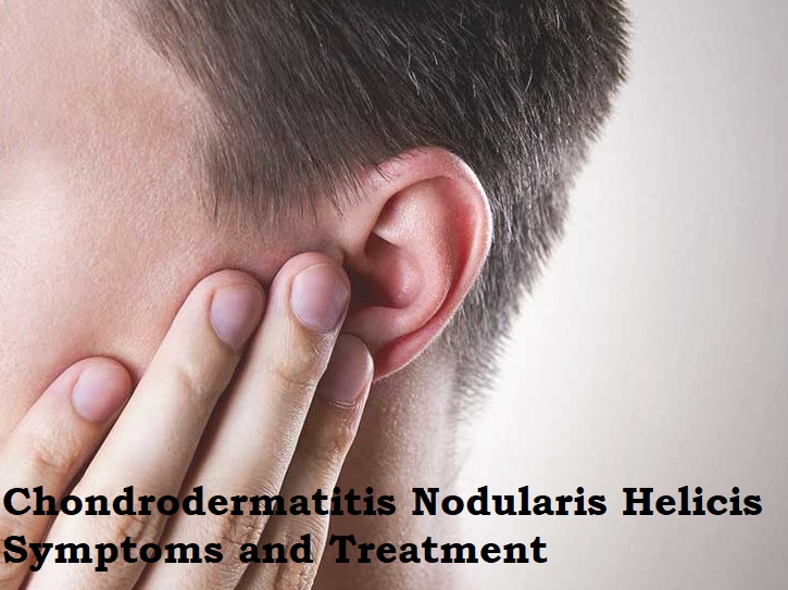 Chondrodermatitis nodularis helicis