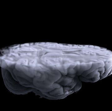 computed tomography of the brain and mri of the brain allows you to get a three dimensional image of various parts of the human brain, including the cerebral cortex, its internal and external parts