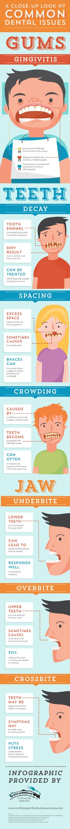 Acids found in bacteria and plaque can attack the tooth enamel, resulting in tooth decay. This condition can result in pain, cavities, and even tooth loss. Check out this infographic from an orthodontist in Allen for more facts about common dental problems. Dental Problems, Pediatric Dentistry, Pediatric Dentist, Dental Treatment, Dental Hygiene School, Dental Hygiene
