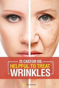 Scrubs, Prevent Wrinkles, Wrinkle Remedies, Oils For Skin, Wrinkle Remover, Natural Oils, Eye Wrinkle, Coconut Oil For Acne, Coconut Oil For Face