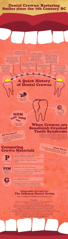 Tooth decay can lead to inflammation, infection, and the need for a root canal treatment. Dentists often use dental crowns to give patients beautiful and natural-looking smiles following root canal therapy. Learn more about the benefits of dental crowns by checking out this image! Infographic source: http://www.atlantadentistszikmangroup.com/597505/2012/11/26/dental-crowns-restoring-smiles-since-the-7th-century-bc.html Dental Crowns, Dental Procedures, Tooth Decay